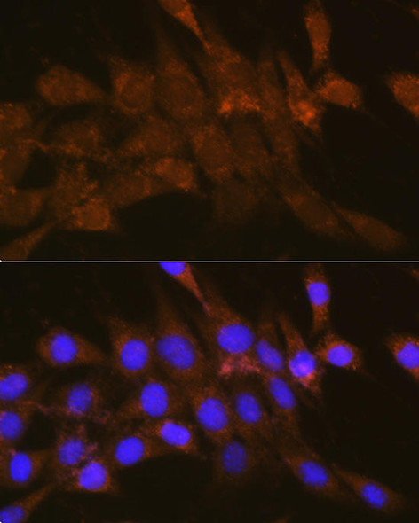 Cell Biology Antibodies 9 Anti-OSBP Antibody CAB3998