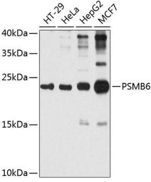 Immunology Antibodies 2 Anti-PSMB6 Antibody CAB4053