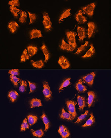 Signal Transduction Antibodies 2 Anti-SGCA Antibody CAB4109