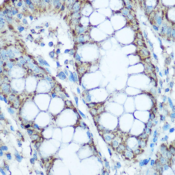 Cell Biology Antibodies 9 Anti-UQCRC2 Antibody CAB4181