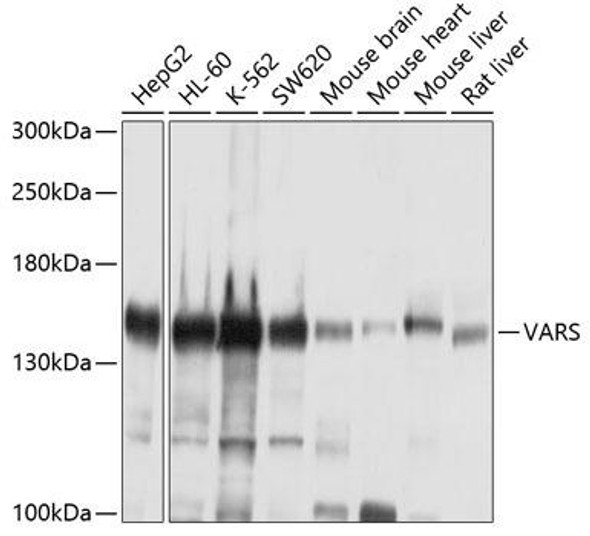 Metabolism Antibodies 2 Anti-VARS Antibody CAB4182