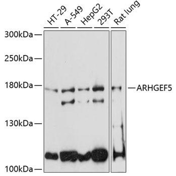 Signal Transduction Antibodies 2 Anti-ARHGEF5 Antibody CAB4196