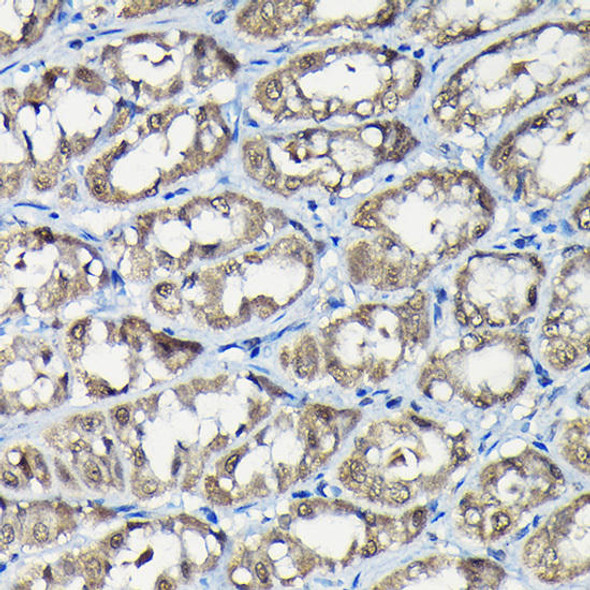 Signal Transduction Antibodies 2 Anti-USP5 Antibody CAB4202