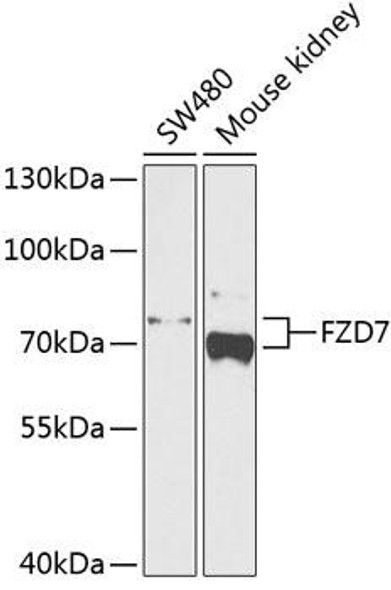 Metabolism Antibodies 2 Anti-FZD7 Antibody CAB4213