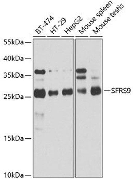 Epigenetics and Nuclear Signaling Antibodies 3 Anti-SFRS9 Antibody CAB4242
