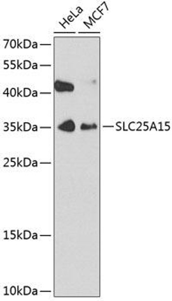 Signal Transduction Antibodies 2 Anti-SLC25A15 Antibody CAB4381