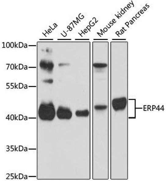 Metabolism Antibodies 2 Anti-ERP44 Antibody CAB4526