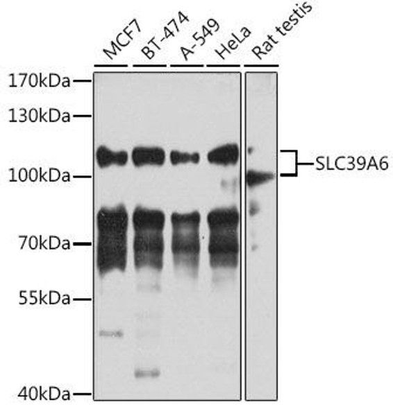 Signal Transduction Antibodies 2 Anti-SLC39A6 Antibody CAB4584