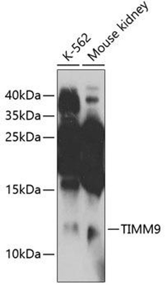 Cell Biology Antibodies 9 Anti-TIMM9 Antibody CAB4627