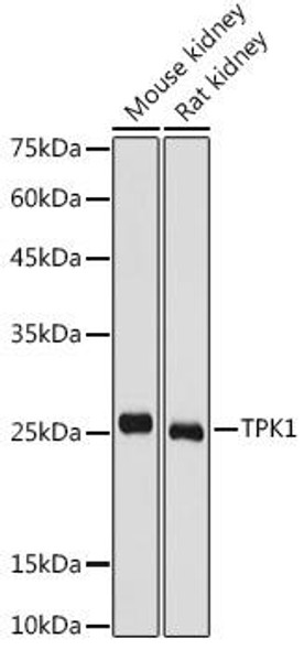 Cell Biology Antibodies 9 Anti-TPK1 Antibody CAB4634