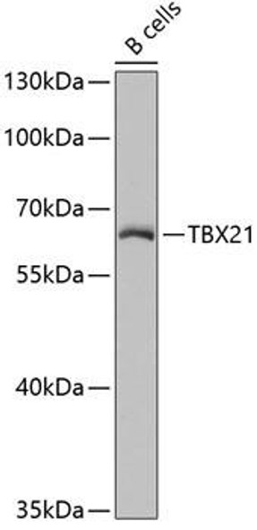 Epigenetics and Nuclear Signaling Antibodies 3 Anti-TBX21 Antibody CAB4682