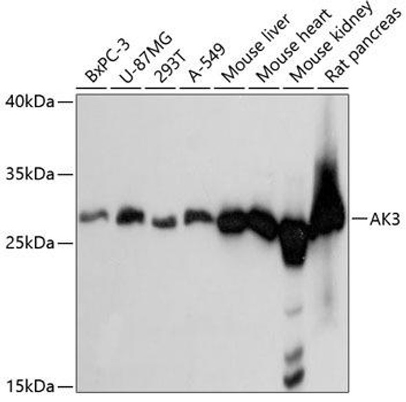 Signal Transduction Antibodies 2 Anti-AK3 Antibody CAB4694