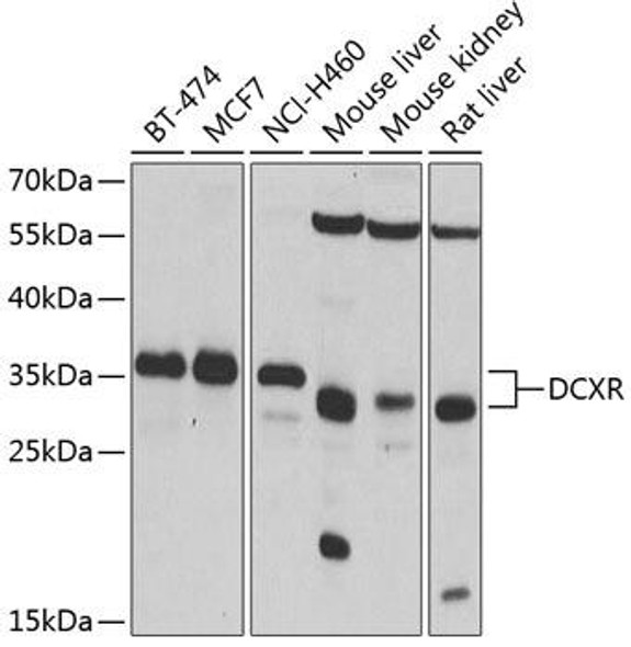 Metabolism Antibodies 2 Anti-DCXR Antibody CAB4721