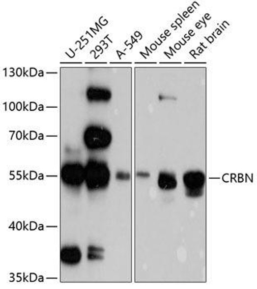 Signal Transduction Antibodies 2 Anti-CRBN Antibody CAB4722