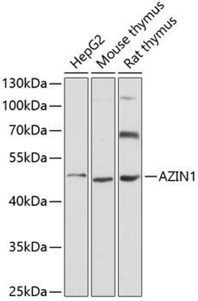 Metabolism Antibodies 2 Anti-AZIN1 Antibody CAB4747