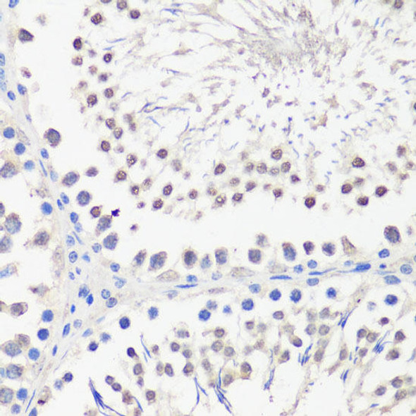 Cell Biology Antibodies 9 Anti-SPK Antibody CAB4852