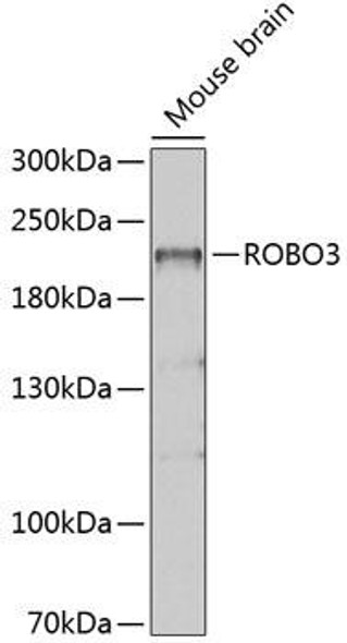 Cell Biology Antibodies 9 Anti-ROBO3 Antibody CAB4924