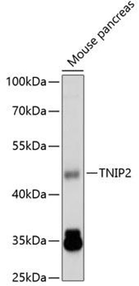 Cell Death Antibodies 2 Anti-TNIP2 Antibody CAB4962