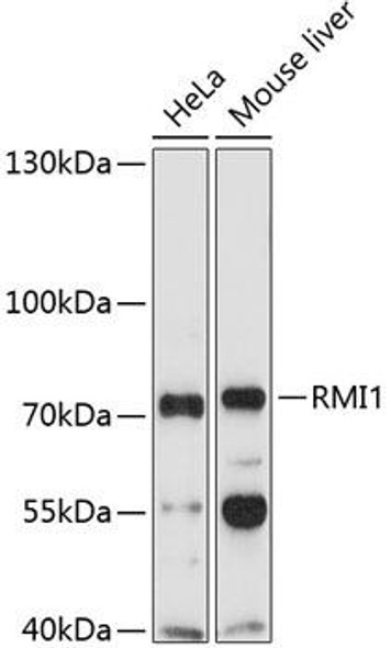 Epigenetics and Nuclear Signaling Antibodies 3 Anti-RMI1 Antibody CAB4991
