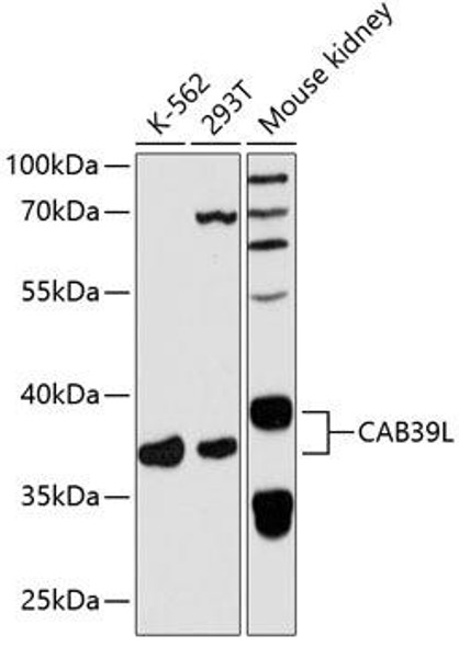 Cell Death Antibodies 2 Anti-CAB39L Antibody CAB5017