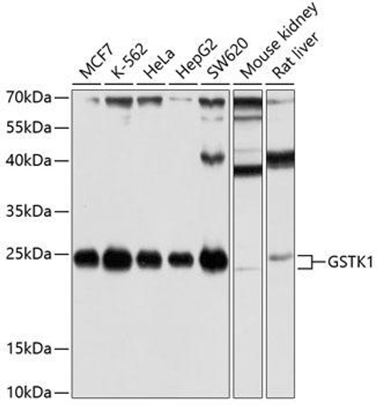 Cell Biology Antibodies 9 Anti-GSTK1 Antibody CAB5226
