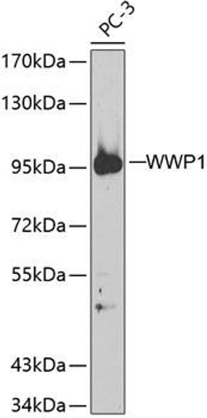 Immunology Antibodies 2 Anti-WWP1 Antibody CAB5269