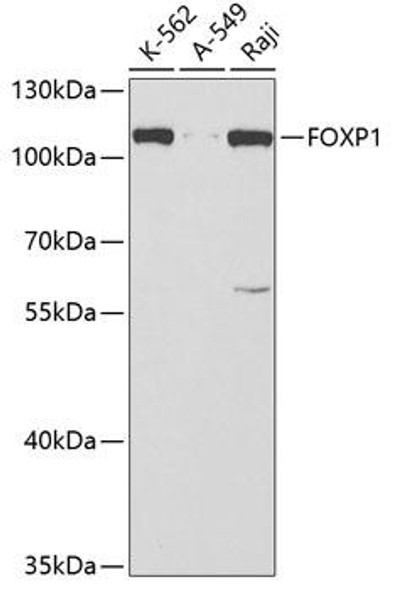 Epigenetics and Nuclear Signaling Antibodies 3 Anti-FOXP1 Antibody CAB5272