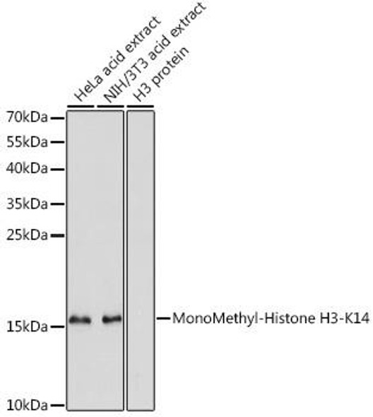 Epigenetics and Nuclear Signaling Antibodies 3 Anti-MonoMethyl-Histone H3-K14 Antibody CAB5277