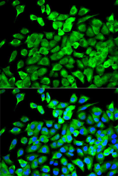 Immunology Antibodies 2 Anti-EIF4A1 Antibody CAB5294