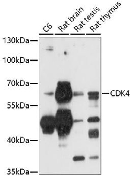 Immunology Antibodies 2 Anti-CAMK4 Antibody CAB5304
