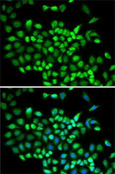 Immunology Antibodies 2 Anti-CUL2 Antibody CAB5308