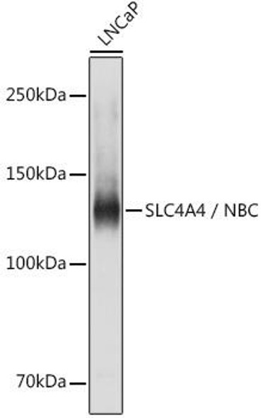 Signal Transduction Antibodies 3 Anti-SLC4A4 / NBC Antibody CAB5332