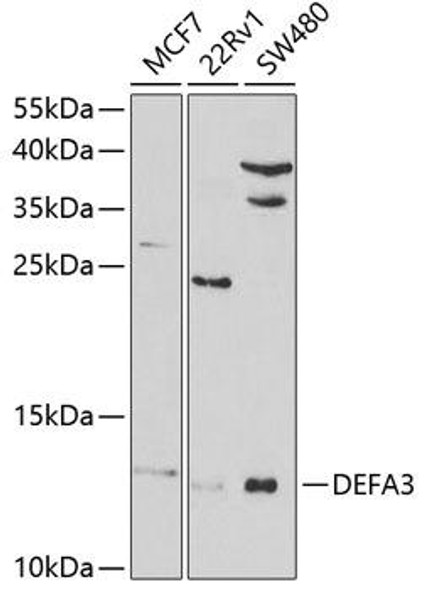 Immunology Antibodies 2 Anti-DEFA3 Antibody CAB5340