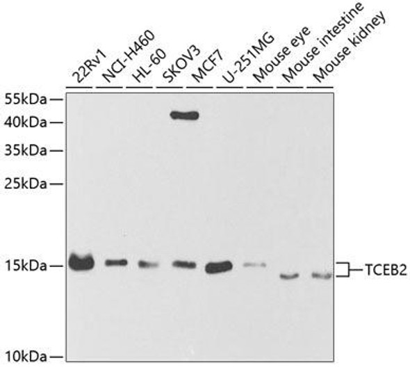Immunology Antibodies 2 Anti-TCEB2 Antibody CAB5362