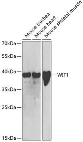 Metabolism Antibodies 2 Anti-WIF1 Antibody CAB5386