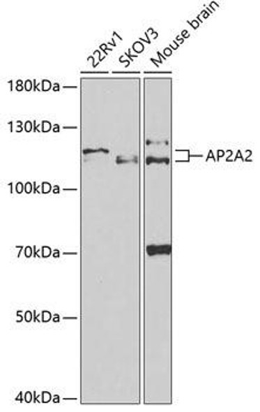Cell Biology Antibodies 9 Anti-AP2A2 Antibody CAB5391