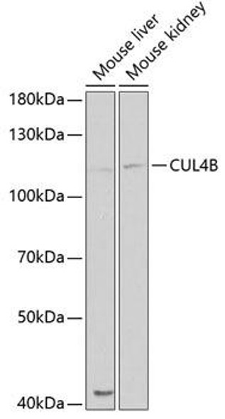 Cell Cycle Antibodies 1 Anti-CUL4B Antibody CAB5400