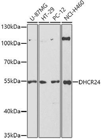 Metabolism Antibodies 2 Anti-DHCR24 Antibody CAB5402