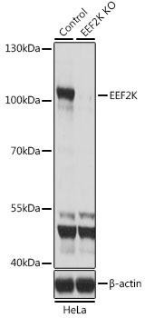 KO Validated Antibodies 1 Anti-EEF2K Antibody CAB5404KO Validated