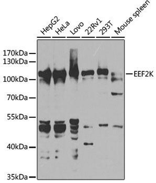 KO Validated Antibodies 1 Anti-EEF2K Antibody CAB5404KO Validated