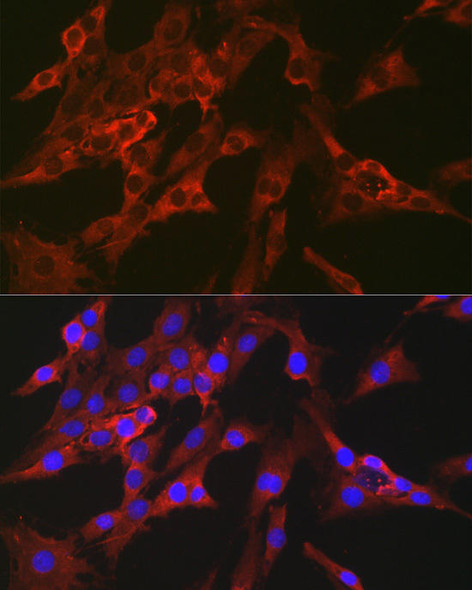 Metabolism Antibodies 2 Anti-FBP1 Antibody CAB5406