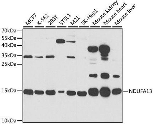 Cell Death Antibodies 2 Anti-NDUFA13 Antibody CAB5412