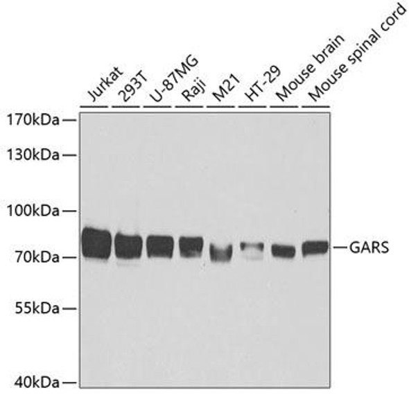 Metabolism Antibodies 2 Anti-GARS Antibody CAB5435