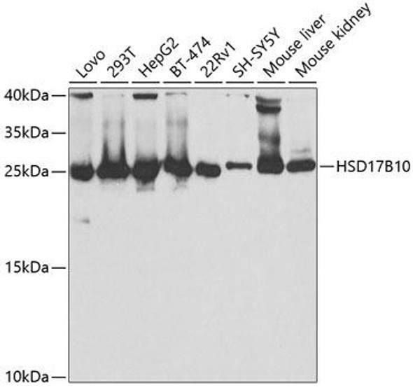 Epigenetics and Nuclear Signaling Antibodies 3 Anti-HSD17B10 Antibody CAB5448