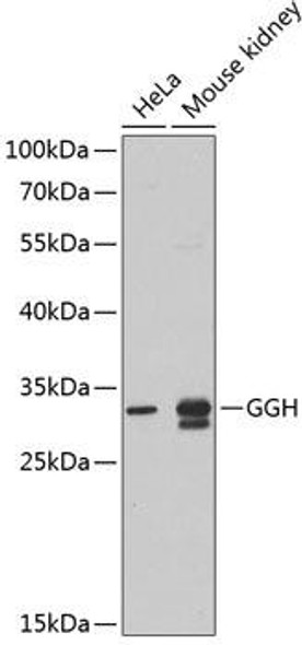 Cell Biology Antibodies 9 Anti-GGH Antibody CAB5464