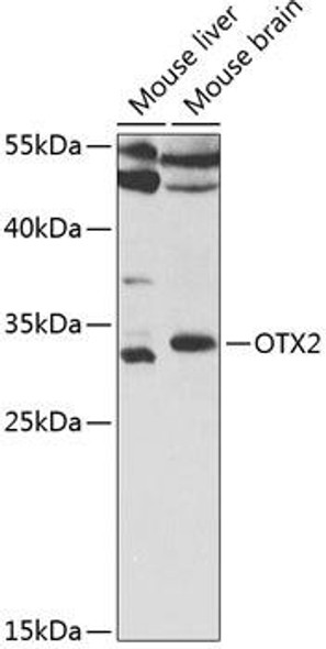 Cell Biology Antibodies 9 Anti-OTX2 Antibody CAB5475