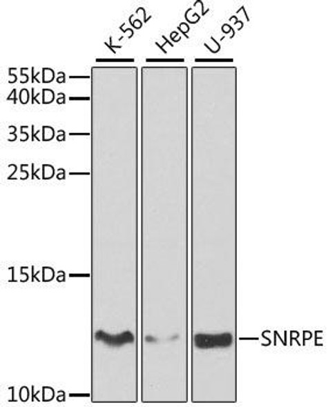 Epigenetics and Nuclear Signaling Antibodies 3 Anti-SNRPE Antibody CAB5488