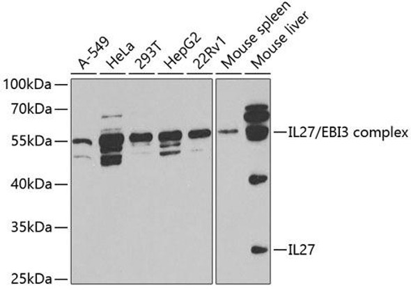 Immunology Antibodies 2 Anti-IL-27 Antibody CAB5498