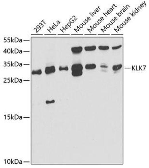 Cell Biology Antibodies 9 Anti-KLK7 Antibody CAB5506