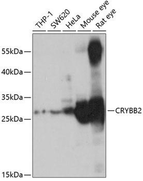 Signal Transduction Antibodies 3 Anti-CRYBB2 Antibody CAB5573